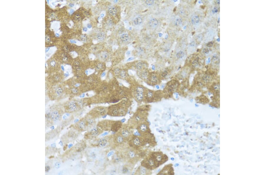 Immunohistochemistry - Anti-BCL2L2 Antibody (A13471) - Antibodies.com