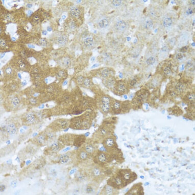 Immunohistochemistry - Anti-BCL2L2 Antibody (A13471) - Antibodies.com