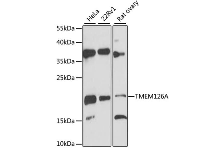 Western Blot - Anti-TMEM126A Antibody (A12823) - Antibodies.com