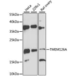 Western Blot - Anti-TMEM126A Antibody (A12823) - Antibodies.com