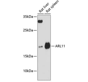 Western Blot - Anti-ARL11 Antibody (A88748) - Antibodies.com