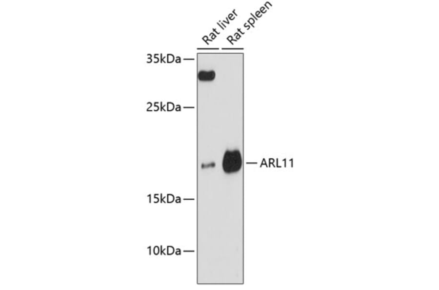 Western Blot - Anti-ARL11 Antibody (A88748) - Antibodies.com