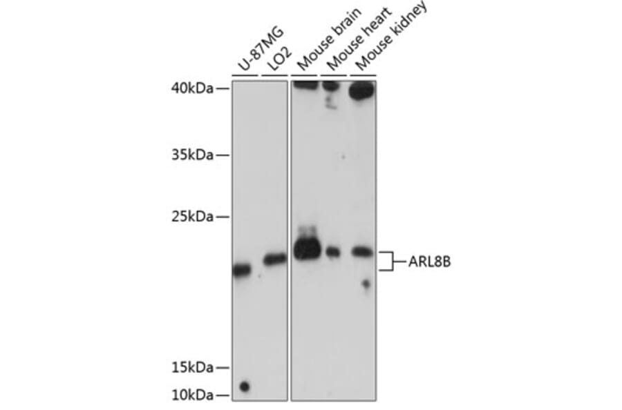 Western Blot - Anti-ARL8B Antibody (A88749) - Antibodies.com