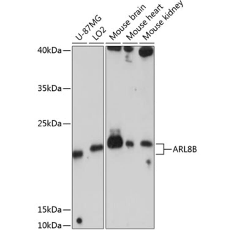 Western Blot - Anti-ARL8B Antibody (A88749) - Antibodies.com