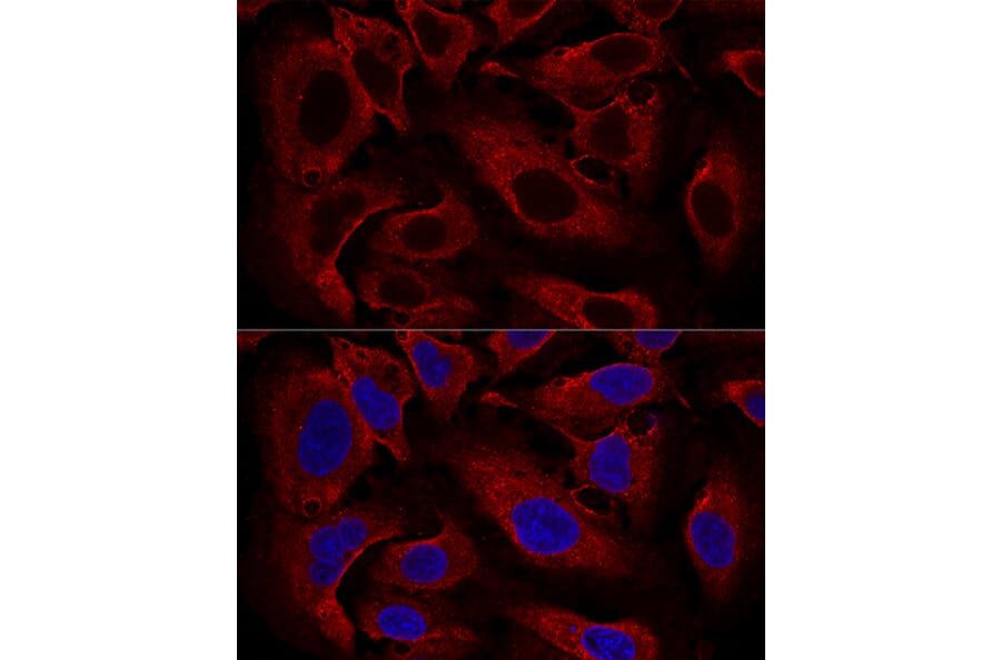Immunofluorescence - Anti-ARL8B Antibody (A88749) - Antibodies.com