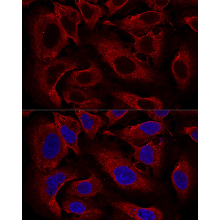 Immunofluorescence - Anti-ARL8B Antibody (A88749) - Antibodies.com