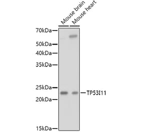 Western Blot - Anti-TP53I11 Antibody (A88750) - Antibodies.com