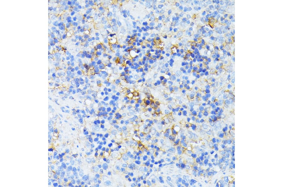 Immunohistochemistry - Anti-TP53I11 Antibody (A88750) - Antibodies.com