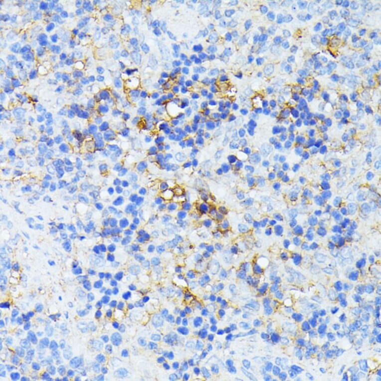 Immunohistochemistry - Anti-TP53I11 Antibody (A88750) - Antibodies.com