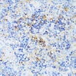 Immunohistochemistry - Anti-TP53I11 Antibody (A88750) - Antibodies.com