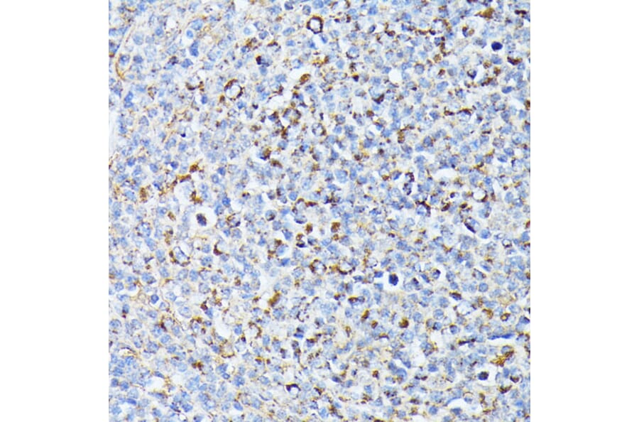 Immunohistochemistry - Anti-TP53I11 Antibody (A88750) - Antibodies.com