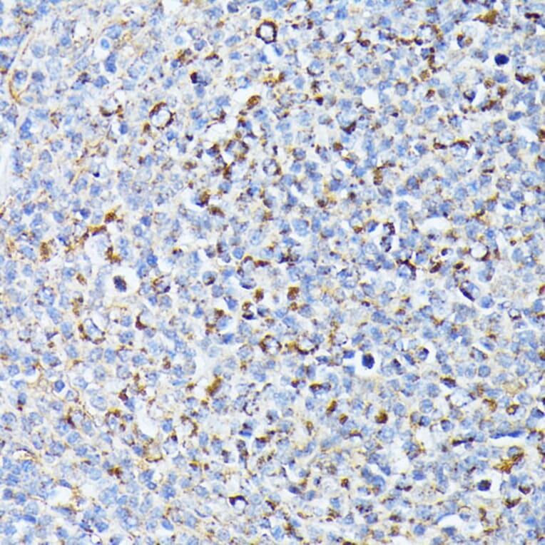 Immunohistochemistry - Anti-TP53I11 Antibody (A88750) - Antibodies.com