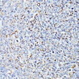 Immunohistochemistry - Anti-TP53I11 Antibody (A88750) - Antibodies.com
