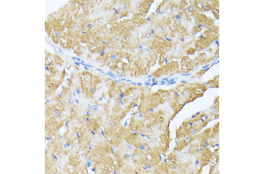 Immunohistochemistry - Anti-TP53I11 Antibody (A88750) - Antibodies.com