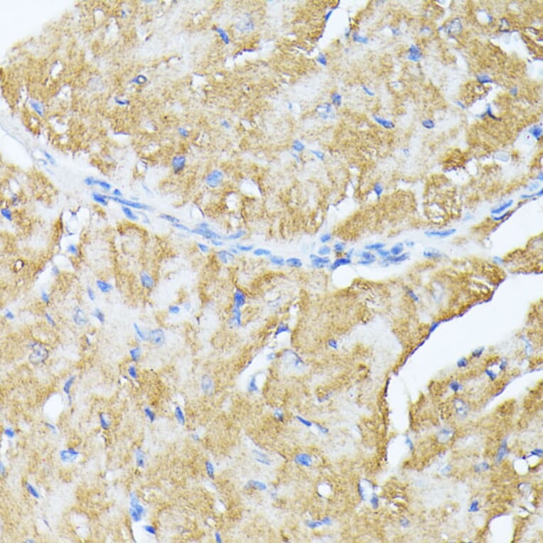 Immunohistochemistry - Anti-TP53I11 Antibody (A88750) - Antibodies.com