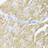 Immunohistochemistry - Anti-TP53I11 Antibody (A88750) - Antibodies.com