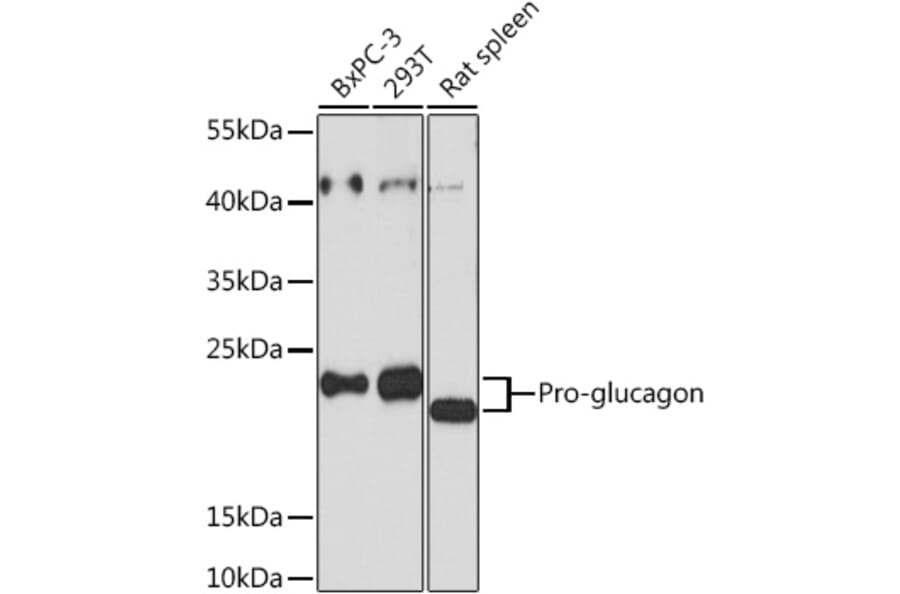 Western Blot - Anti-Glucagon Antibody (A88751) - Antibodies.com
