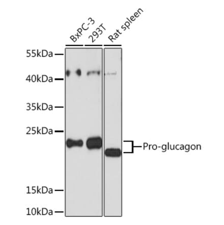 Western Blot - Anti-Glucagon Antibody (A88751) - Antibodies.com