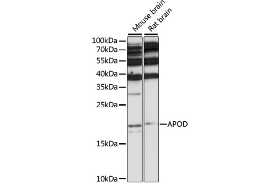 Western Blot - Anti-APOD Antibody (A15640) - Antibodies.com