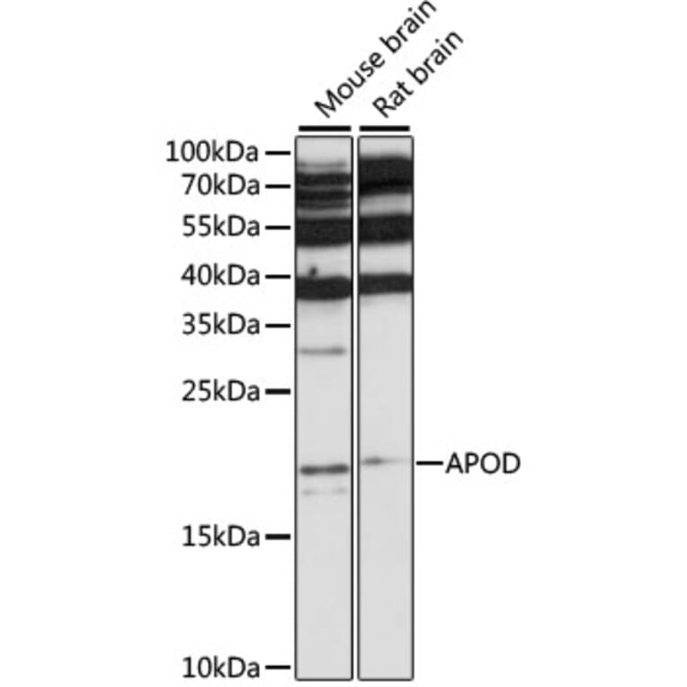 Western Blot - Anti-APOD Antibody (A15640) - Antibodies.com