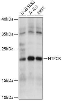 Western blot analysis of extracts of various cell lines, using Anti-NTPCR Antibody (A14944) at 1:1,000 dilution.
Secondary antibody: Goat Anti-Rabbit IgG (H+L) (HRP) (AS014) at 1:10,000 dilution.
Lysates / proteins: 25µg per lane.
Blocking buffer: 3% non-fat dry milk in TBST.
Detection: ECL Basic Kit (RM00020).
Exposure time: 10s.