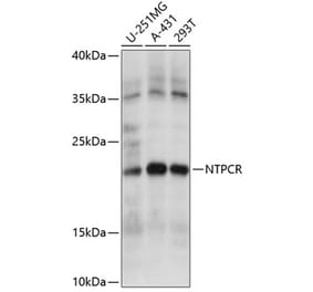 Western Blot - Anti-Nucleoside triphosphate phosphohydrolase Antibody (A88753) - Antibodies.com