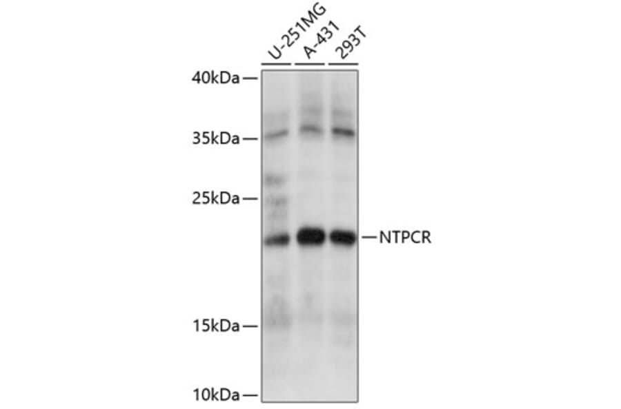 Western Blot - Anti-Nucleoside triphosphate phosphohydrolase Antibody (A88753) - Antibodies.com