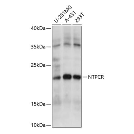 Western Blot - Anti-Nucleoside triphosphate phosphohydrolase Antibody (A88753) - Antibodies.com