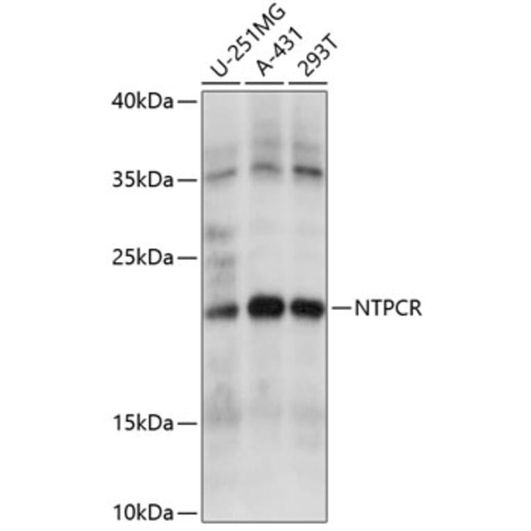 Western Blot - Anti-Nucleoside triphosphate phosphohydrolase Antibody (A88753) - Antibodies.com