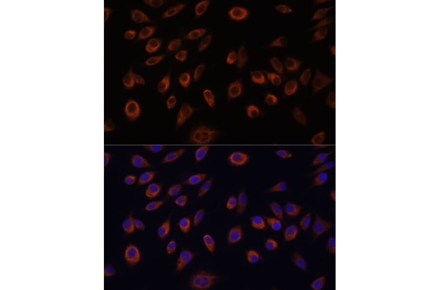 Immunofluorescence - Anti-Nucleoside triphosphate phosphohydrolase Antibody (A88753) - Antibodies.com