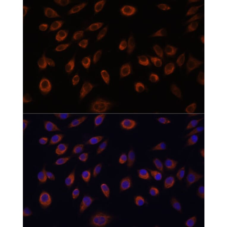 Immunofluorescence - Anti-Nucleoside triphosphate phosphohydrolase Antibody (A88753) - Antibodies.com