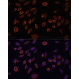 Immunofluorescence - Anti-Nucleoside triphosphate phosphohydrolase Antibody (A88753) - Antibodies.com