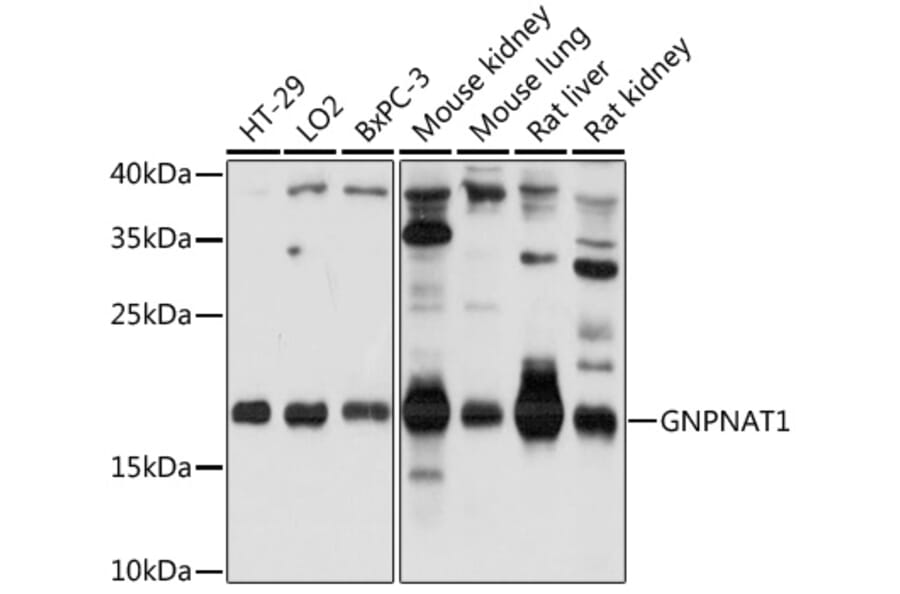 Western Blot - Anti-GNPNAT1 Antibody (A88754) - Antibodies.com