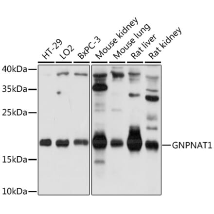 Western Blot - Anti-GNPNAT1 Antibody (A88754) - Antibodies.com