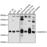 Western Blot - Anti-GNPNAT1 Antibody (A88754) - Antibodies.com