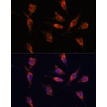 Immunofluorescence - Anti-GNPNAT1 Antibody (A88754) - Antibodies.com