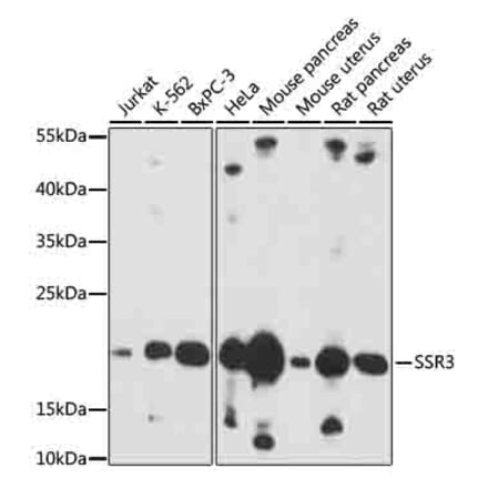 Western Blot - Anti-SSR3 Antibody (A88755) - Antibodies.com