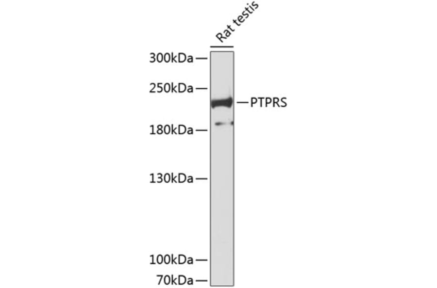 Western Blot - Anti-PTPRS Antibody (A8866) - Antibodies.com