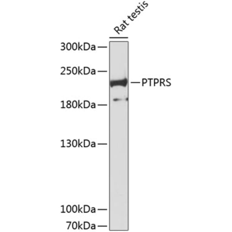 Western Blot - Anti-PTPRS Antibody (A8866) - Antibodies.com