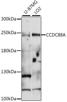 Western blot analysis of extracts of various cell lines, using Anti-CCDC88A Antibody (A16132) at 1:1,000 dilution.
Secondary antibody: Goat Anti-Rabbit IgG (H+L) (HRP) (AS014) at 1:10,000 dilution.
Lysates / proteins: 25µg per lane.
Blocking buffer: 3% non-fat dry milk in TBST.
Detection: ECL Basic Kit (RM00020).
Exposure time: 90s.