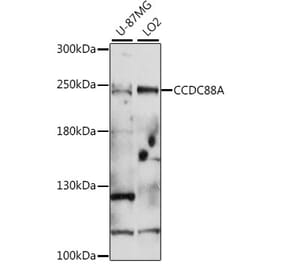 Western Blot - Anti-GIV Antibody (A88757) - Antibodies.com