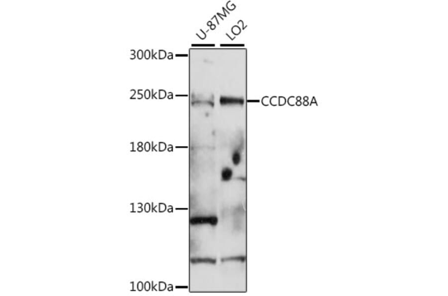 Western Blot - Anti-GIV Antibody (A88757) - Antibodies.com