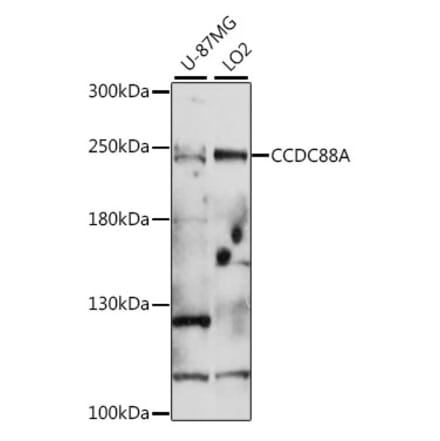 Western Blot - Anti-GIV Antibody (A88757) - Antibodies.com