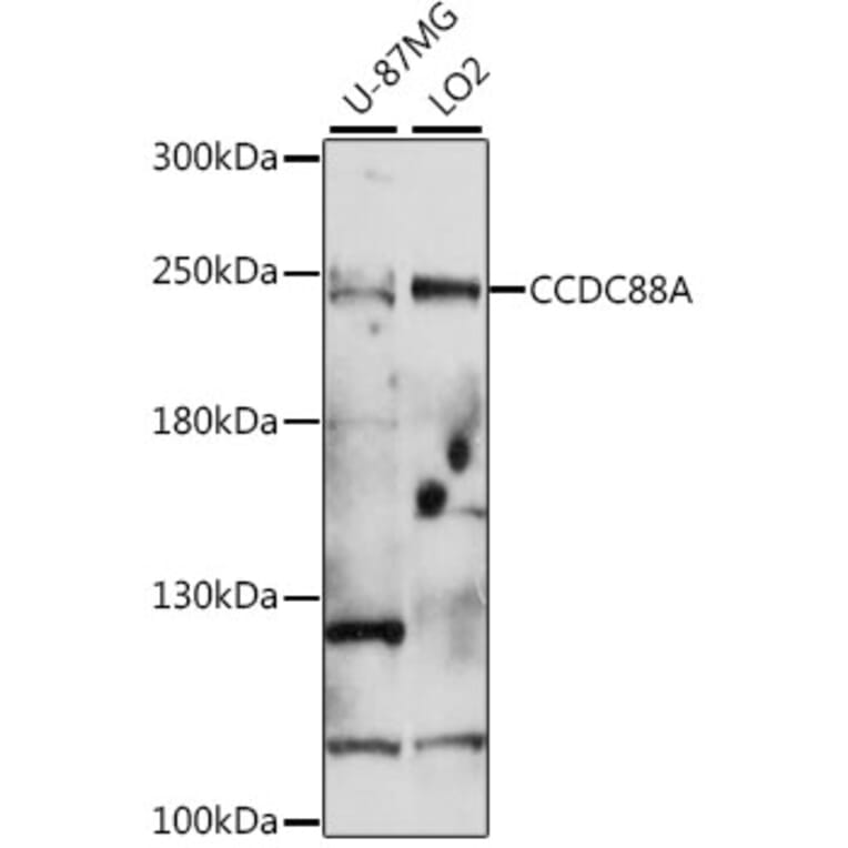 Western Blot - Anti-GIV Antibody (A88757) - Antibodies.com