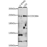 Western Blot - Anti-GIV Antibody (A88757) - Antibodies.com