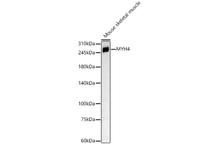 Western Blot - Anti-Myosin Antibody (A88758) - Antibodies.com