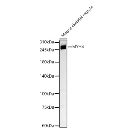 Western Blot - Anti-Myosin Antibody (A88758) - Antibodies.com