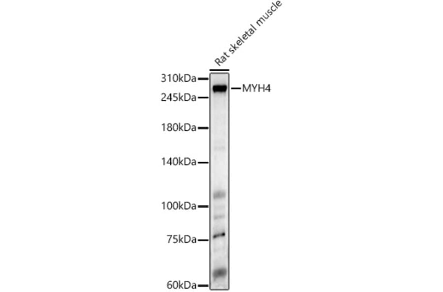 Western Blot - Anti-Myosin Antibody (A88758) - Antibodies.com