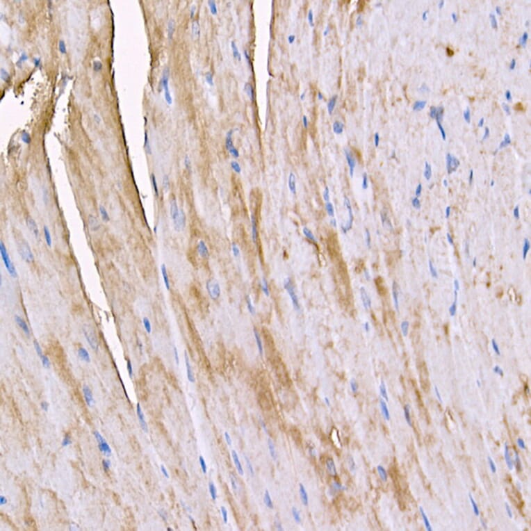 Immunohistochemistry - Anti-Myosin Antibody (A88758) - Antibodies.com