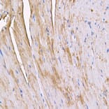 Immunohistochemistry - Anti-Myosin Antibody (A88758) - Antibodies.com